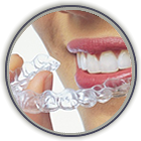 Invisalign