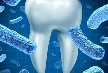 Understanding the Causes and Effects of Gingivitis